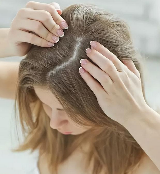 头发稀疏怎么恢复