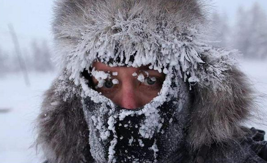 冬天如何防止冻疮